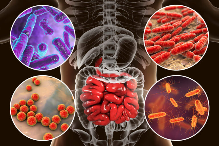Gut microbiota