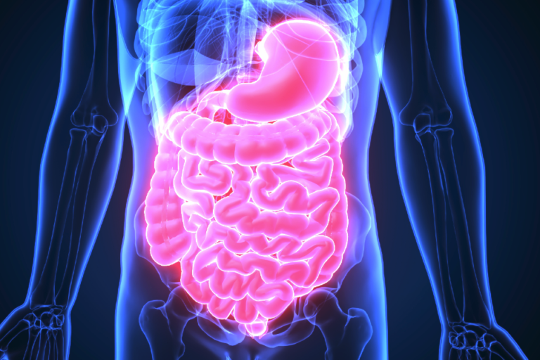 dietary interventions